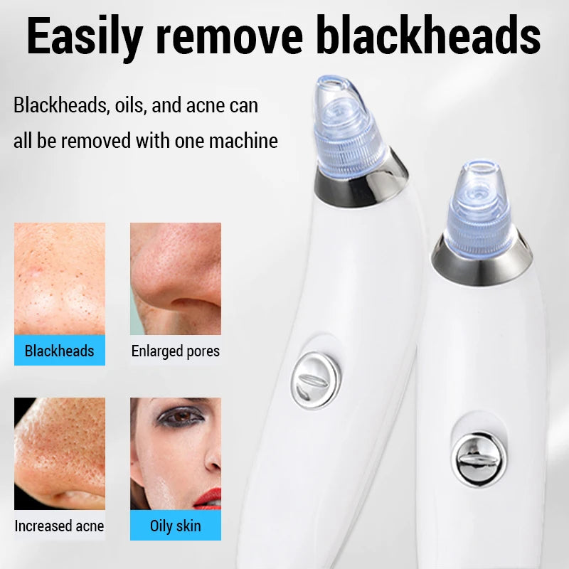 Electric Blackhead Removal Instrument instrument pore cleanser electric suction Face Pore Cleansing Beauty Instrument Skin Care