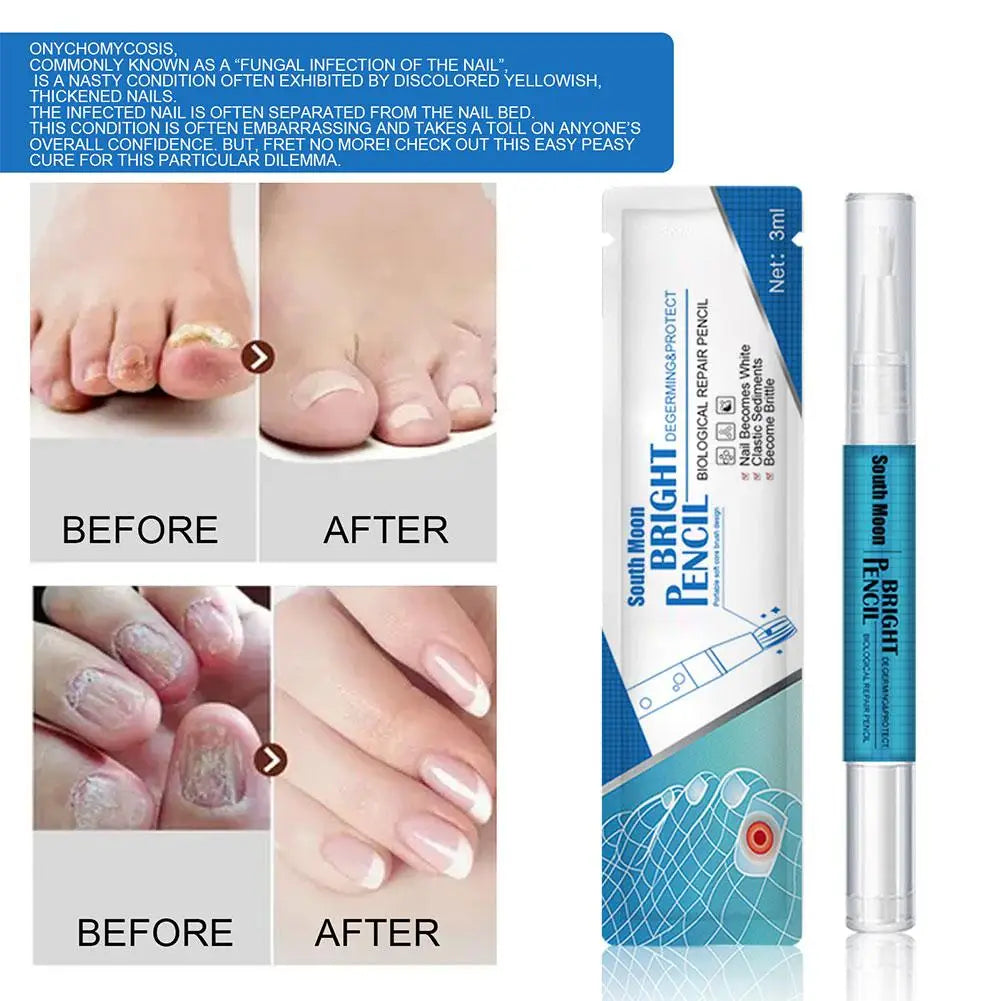3ML Nail Fungal Treatment Pen Anti Fungus Infection Biological Healthy Oil Solution effective Repair Nutritious Toenails
