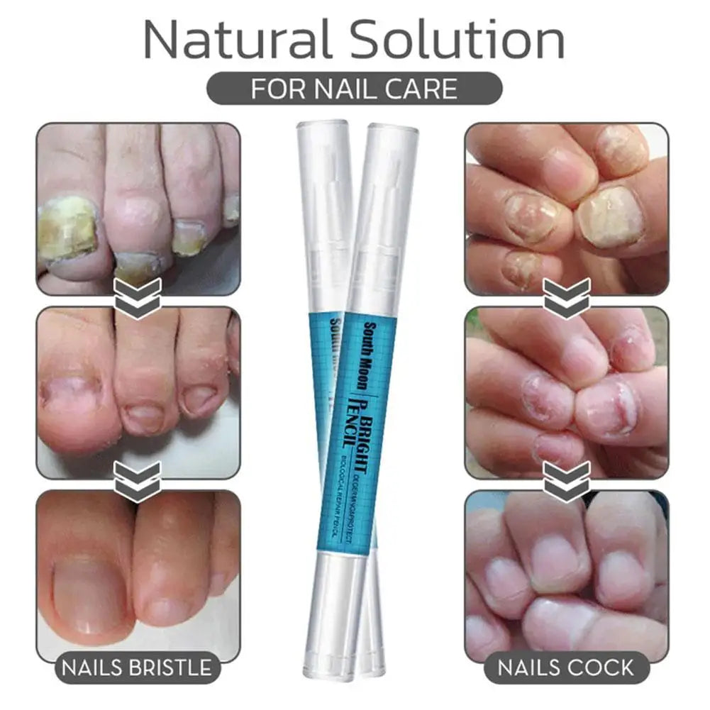3ML Nail Fungal Treatment Pen Anti Fungus Infection Biological Healthy Oil Solution effective Repair Nutritious Toenails