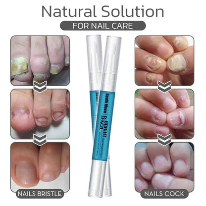 3ml Nail Fungal Treatment Pen, Antifungal Nail Care Oil, Toenail Repair Treatment