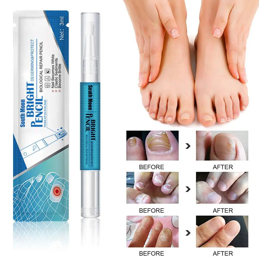 3ML Nail Fungal Treatment Pen Anti Fungus Infection Biological Healthy Oil Solution effective Repair Nutritious Toenails