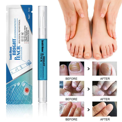 3ml Nail Fungal Treatment Pen, Antifungal Nail Care Oil, Toenail Repair Treatment