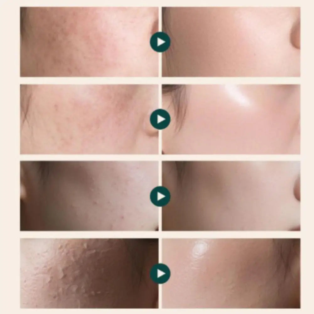 Advanced Rejuvenating Cream 20g PDRN Anti-Aging Moisturizer Cream Skin Care Moisturizing Repair Revitalizing All Skin Types New
