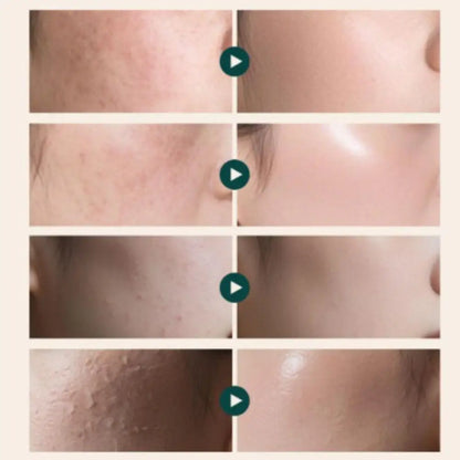 PDRN Rejuvenating Face Cream 20g | Moisturizing Skin Repair & Revitalizing Facial Cream