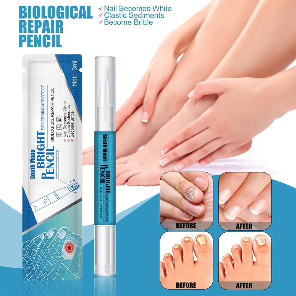 3ML Nail Fungal Treatment Pen Anti Fungus Infection Biological Healthy Oil Solution effective Repair Nutritious Toenails