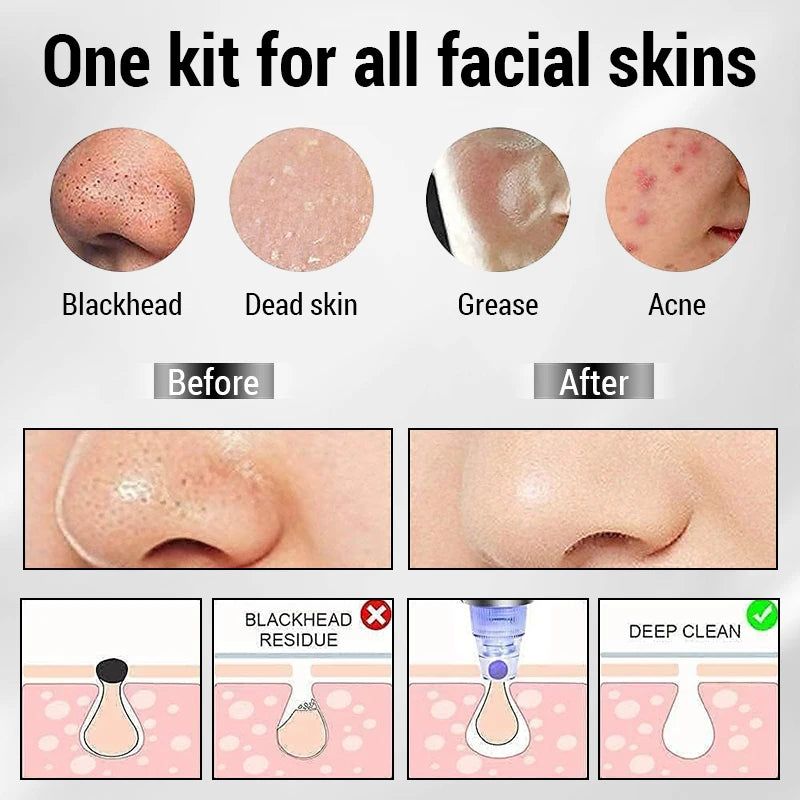 Electric Blackhead Removal Instrument instrument pore cleanser electric suction Face Pore Cleansing Beauty Instrument Skin Care