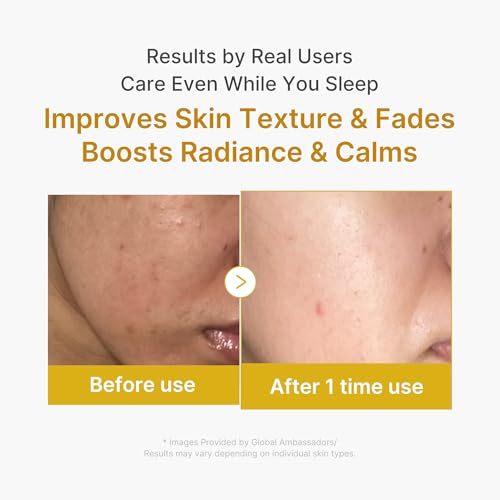 medicube Turmeric Overnight Wrapping Peel-Off Mask – Hydrating Facial Mask